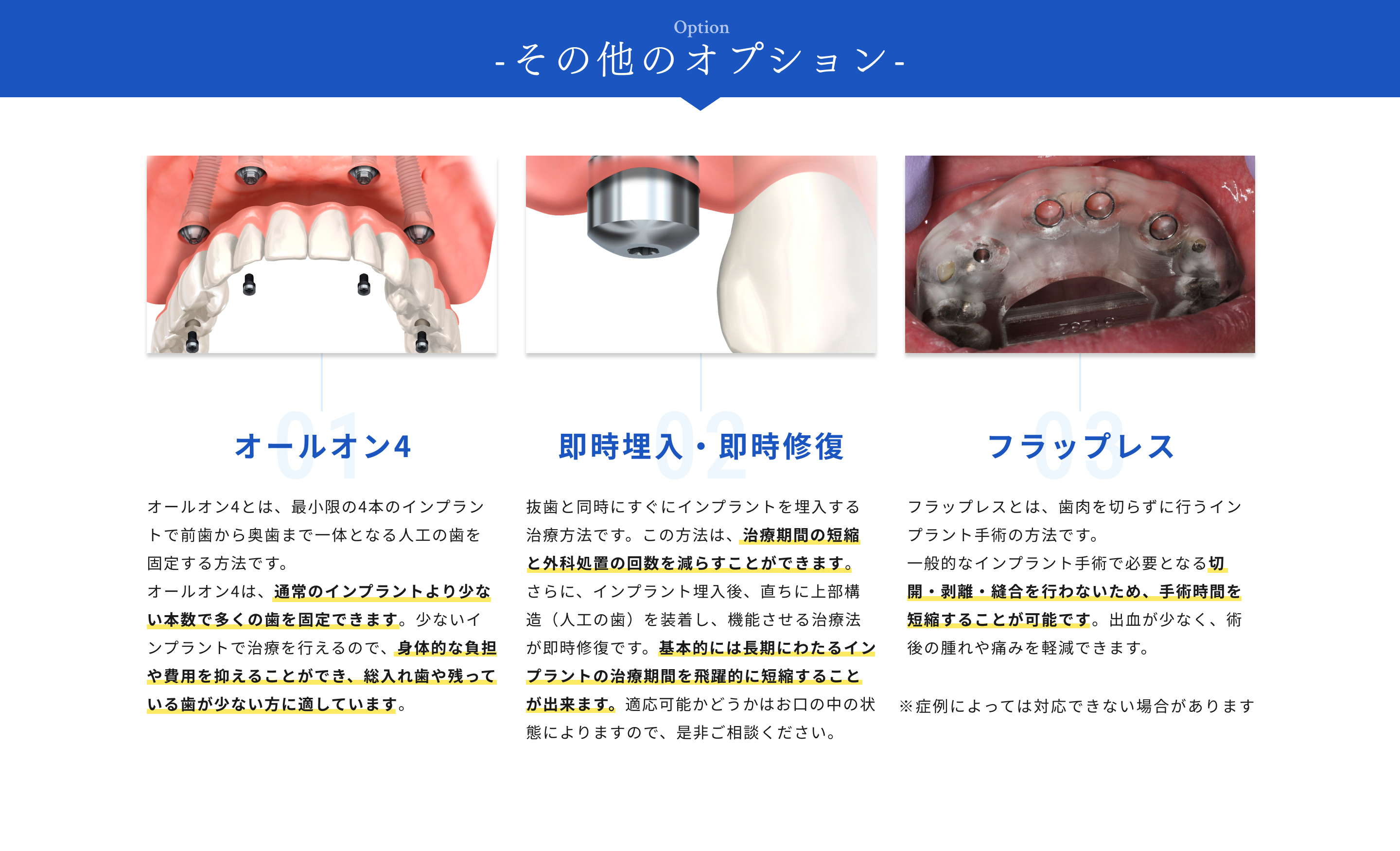 その他のオプション